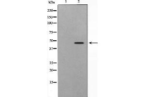 Western blot analysis on 293 cell lysate using SKP2/p45 Antibody,The lane on the left is treated with the antigen-specific peptide. (SKP2 抗体  (C-Term))