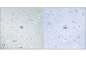 Immunohistochemistry analysis of paraffin-embedded human brain tissue, using PE2R3 Antibody. (PTGER3 抗体  (AA 1-50))