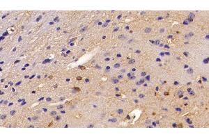 Immunohistochemistry (IHC) image for anti-S100 Calcium Binding Protein B (S100B) (AA 1-92) antibody (ABIN7432073)