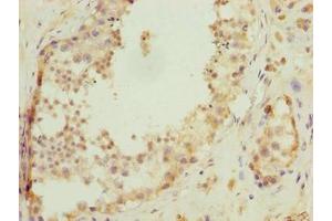 Immunohistochemistry of paraffin-embedded human testis tissue using ABIN7174751 at dilution of 1:100 (C17ORF47 抗体  (AA 1-300))