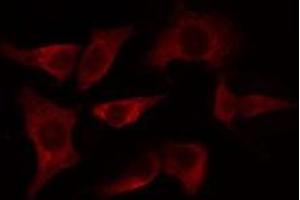ABIN6275106 staining HeLa cells by IF/ICC. (ELOVL4 抗体  (Internal Region))