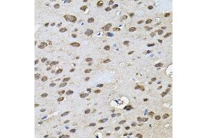 Immunohistochemistry of paraffin-embedded rat brain using RNF166 antibody. (RNF166 抗体)