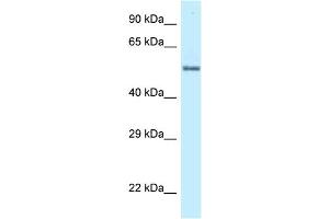 WB Suggested Anti-ZNF384 Antibody Titration: 1. (ZNF384 抗体  (C-Term))