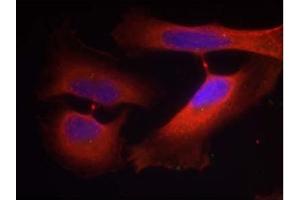 Image no. 1 for anti-Keratin 8 (KRT8) (pSer74) antibody (ABIN401539) (KRT8 抗体  (pSer74))