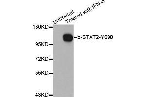 Western blot analysis of extracts from Hela cells using Phospho-STAT2-Y690 antibody. (STAT2 抗体  (pTyr690))