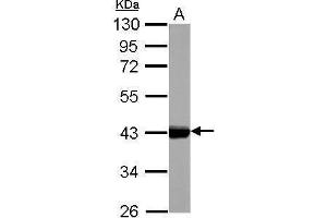 WB Image Sample (50 ug of whole cell lysate) A: Rat bladder 10% SDS PAGE antibody diluted at 1:10000 (KRT17 抗体)