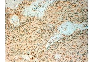Immunohistochemistry: TET2 Antibody staining of Paraffin Embedded Human Spleen at 4 µg/ml. (TET2 抗体  (Internal Region))