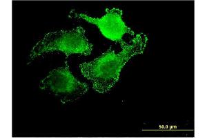 Immunofluorescence of monoclonal antibody to UNC5CL on HeLa cell. (UNC5CL 抗体  (AA 1-518))