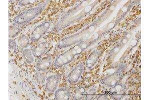 Image no. 4 for anti-Hematopoietic Cell-Specific Lyn Substrate 1 (HCLS1) (AA 266-356) antibody (ABIN598726) (HCLS1 抗体  (AA 266-356))