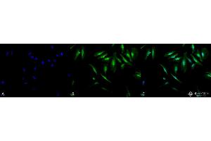 Immunocytochemistry/Immunofluorescence analysis using Rabbit Anti-Alpha B Crystallin Polyclonal Antibody . (CRYAB 抗体  (APC))