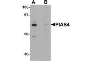 Western blot analysis of PIAS4 in rat brain tissue lysate with PIAS4 antibody at 1 μg/ml in (A) the absence and (B) the presence of blocking peptide. (PIAS4 抗体  (N-Term))