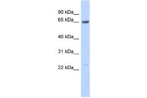 WB Suggested Anti-SSX7 Antibody Titration:  0. (SSX7 抗体  (Middle Region))