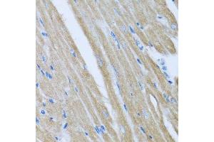 Immunohistochemistry of paraffin-embedded mouse heart using CCM2 antibody. (CCM2 抗体  (AA 1-300))