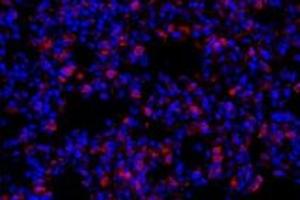 Immunofluorescent analysis of paraformaldehyde-fixed rat lung using,Claudin 10 (ABIN7073514) at dilution of 1: 800 (CLDN10 抗体)