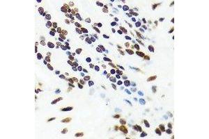 Immunohistochemistry (IHC) image for anti-Vaccinia Related Kinase 1 (VRK1) antibody (ABIN7308494) (VRK1 抗体)