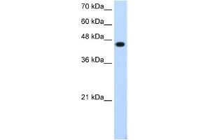 Western Blotting (WB) image for anti-Transcription Factor AP-2 epsilon (Activating Enhancer Binding Protein 2 Epsilon) (TFAP2E) (C-Term) antibody (ABIN2778575)