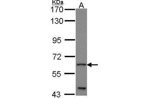 GLIS1 抗体  (C-Term)