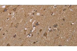 Immunohistochemistry of paraffin-embedded Human brain using GALK1 Polyclonal Antibody at dilution of 1:40 (GALK1 抗体)