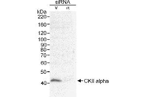 Western Blotting (WB) image for anti-Casein Kinase 2 alpha 1 (CSNK2A1) (AA 1-50) antibody (ABIN7452878) (CSNK2A1/CK II alpha 抗体  (AA 1-50))