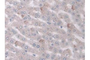DAB staining on IHC-P; Samples: Rat Liver Tissue (COX-1 抗体  (AA 23-277))