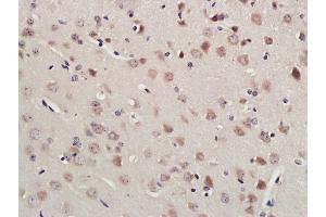 Paraformaldehyde-fixed, paraffin embedded Mouse brain; Antigen retrieval by boiling in sodium citrate buffer (pH6. (RNF213 抗体  (AA 4750-4800))