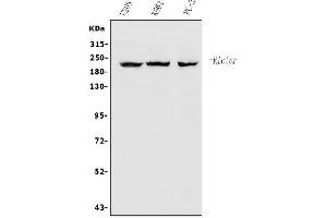 Western blot analysis of RICTOR using anti-RICTOR antibody (ABIN7600744).