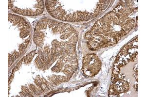 Immunohistochemistry (IHC) image for anti-HRas proto-oncogene, GTPase (HRAS) (C-Term) antibody (ABIN2857002)