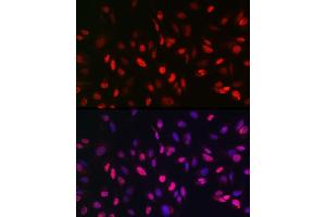 Immunofluorescence analysis of U2OS cells using KDM3A Rabbit pAb (ABIN6134725, ABIN6142790, ABIN6142791 and ABIN6215526) at dilution of 1:150 (40x lens). (KDM3A 抗体  (AA 350-450))