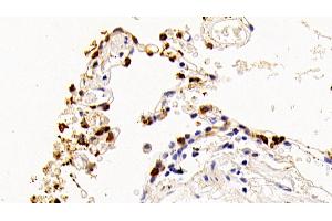 Detection of SPA2 in Human Lung Tissue using Polyclonal Antibody to Surfactant Associated Protein A2 (SPA2) (SFTPA2 抗体  (AA 21-114))