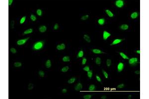 Immunofluorescence of monoclonal antibody to SES2 on HeLa cell. (Sestrin 2 抗体  (AA 1-480))