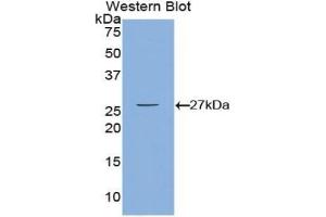 Detection of Recombinant CAMK2g, Mouse using Polyclonal Antibody to Calcium/Calmodulin Dependent Protein Kinase II Gamma (CAMK2g) (CAMKII gamma 抗体  (AA 75-281))