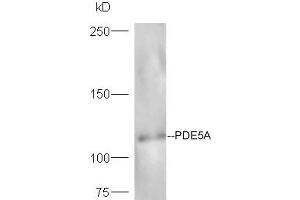 Lane 1: mouse heart probed with Rabbit Anti-Axin1 Polyclonal Antibody, Unconjugated (ABIN740295) at 1:300 overnight at 4 °C. (Axin 抗体  (AA 761-862))