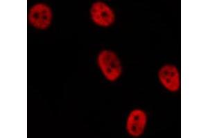 ABIN6276871 staining  COLO205 cells by IF/ICC. (Cyclin D2 抗体  (C-Term))
