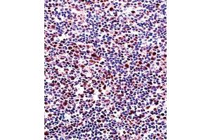 Immunohistochemistry (IHC) image for anti-Runt-Related Transcription Factor 2 (RUNX2) antibody (ABIN3003461) (RUNX2 抗体)