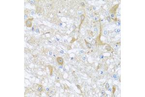 Immunohistochemistry of paraffin-embedded rat brain using SULT1A1 antibody at dilution of 1:100 (x40 lens). (SULT1A1 抗体)