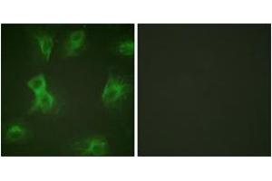 Immunofluorescence analysis of HeLa cells treated with Forskolin 40nM 15', using HRS (Phospho-Tyr334) Antibody. (HRS (HRS) (AA 301-350), (pTyr334) 抗体)
