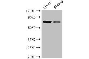 Western Blot Positive WB detected in: Mouse liver tissue, Mouse kidney tissue All lanes: DEF6 antibody at 4 μg/mL Secondary Goat polyclonal to rabbit IgG at 1/50000 dilution Predicted band size: 74 kDa Observed band size: 74 kDa (DEF6 抗体  (AA 20-114))