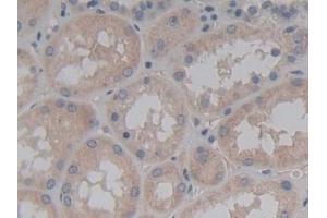 Immunohistochemistry (IHC) image for anti-ATP-Binding Cassette, Sub-Family C (CFTR/MRP), Member 2 (ABCC2) (AA 1300-1534) antibody (ABIN7441076)
