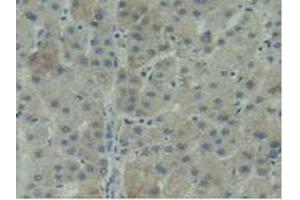 IHC-P analysis of Human Liver Tissue, with DAB staining. (ITGAD 抗体  (AA 879-1099))
