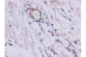 Detection of TIMP2 in Human Mammary gland Tissue using Polyclonal Antibody to Tissue Inhibitors Of Metalloproteinase 2 (TIMP2) (TIMP2 抗体  (AA 27-220))