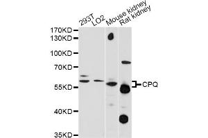Western blot analysis of extracts of various cell lines, using CPQ antibody (ABIN6293987) at 1:1000 dilution. (CPQ 抗体)