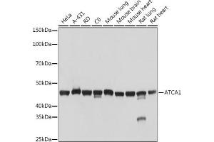 Western blot analysis of extracts of various cell lines, using α-Actin-1  Rabbit mAb (ABIN3015986, ABIN3015987, ABIN1680683 and ABIN1680684) at 1:1000 dilution. (Actin 抗体)