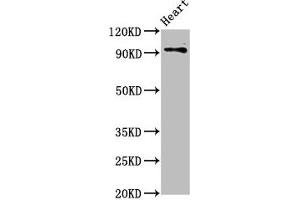Western Blot Positive WB detected in: Rat heart tissue All lanes: DLG2 antibody at 2. (DLG2 抗体  (AA 310-420))
