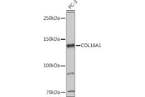 Western blot analysis of extracts of PC-3 cells, using COL16 antibody (8837) at 1:1000 dilution. (COL16A1 抗体  (AA 1000-1100))