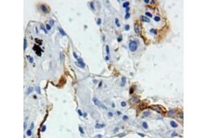 IHC-P analysis of lung tissue, with DAB staining. (SFTPB 抗体  (AA 201-381))
