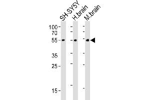 Western blot analysis of lysates from SH-SY5Y cell line, human brain, mouse brain tissue(from left to right), using CHRM2 Antibody (ABIN6242476 and ABIN6577085). (Muscarinic Acetylcholine Receptor M2 抗体)
