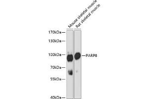 Western blot analysis of extracts of various cell lines, using P antibody (ABIN6133216, ABIN6145242, ABIN6145243 and ABIN6216694) at 1:3000 dilution. (PARP8 抗体  (AA 1-300))