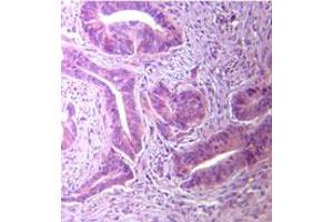 TLR5 Immunohistochemistry. (TLR5 抗体)
