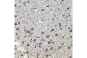 Immunohistochemistry of paraffin-embedded rat brain using MYCN antibody. (MYCN 抗体)