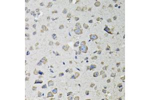 Immunohistochemistry of paraffin-embedded mouse brain using RASSF1 antibody (ABIN6293520) at dilution of 1:100 (40x lens). (RASSF1 抗体)